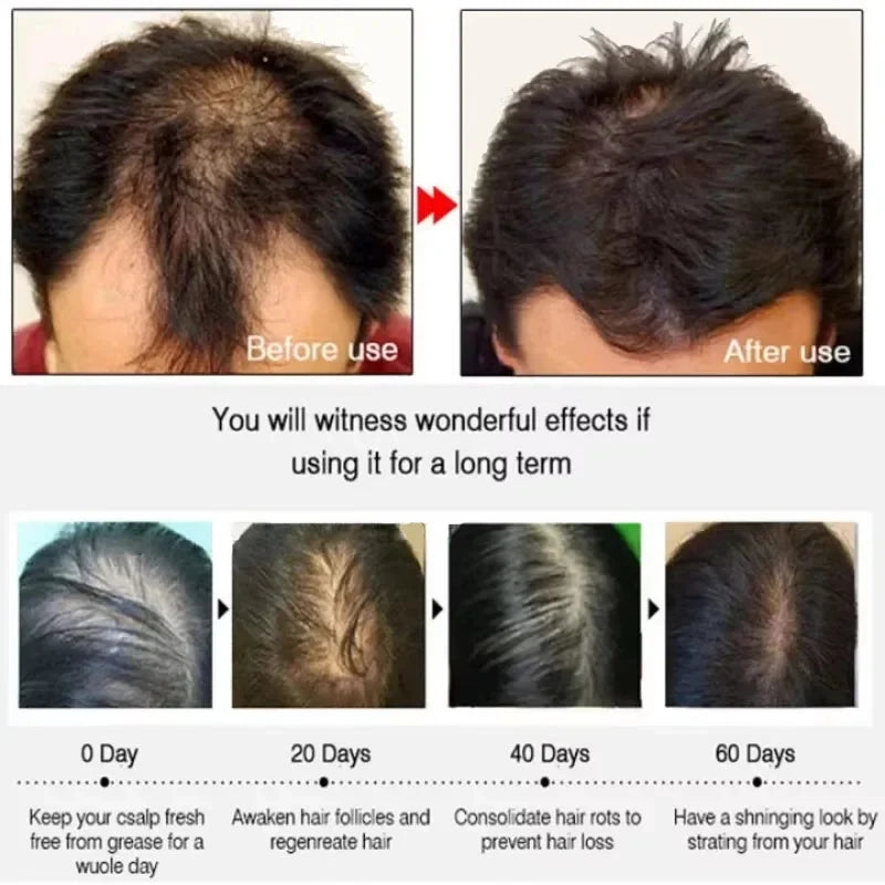 https://cdn.dropmagic.ai/medias/a1766b9a-f696-49d5-b063-534752da09c8.webp